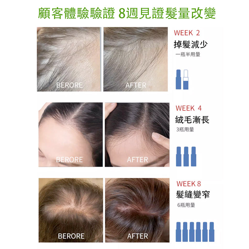 Newmo - 育髮劑 育髮精華 75毫升 育髮防脫 激活毛囊 強韌髮絲 - 日本製造