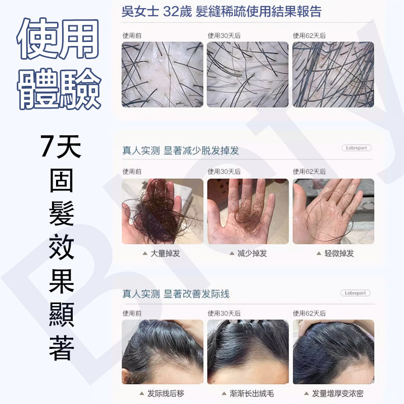 Newmo - 益生元洗髮水 280毫升 深層清潔 頭皮舒緩 強韌防斷髮 防脫髮 - 日本製造
